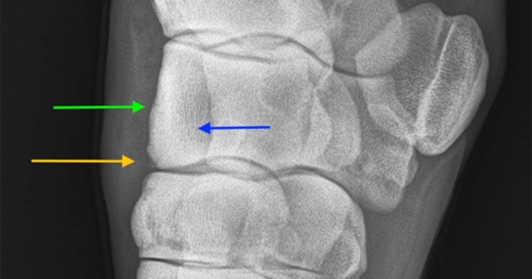 Carpal lameness in 4 year old Warmblood Gelding | Arthramid Vet Australia