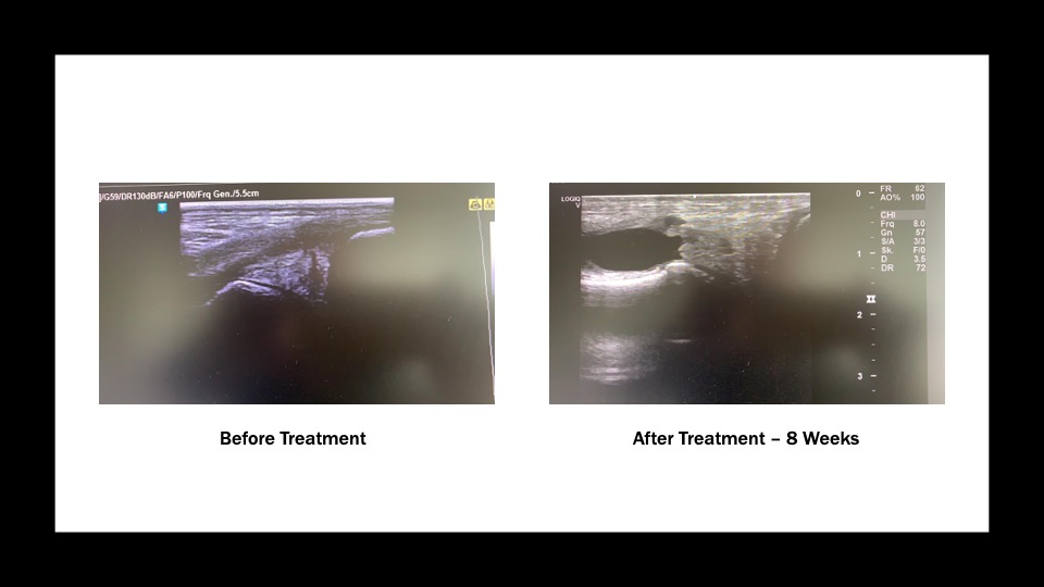 ultrasound scan horse meniscus injury 